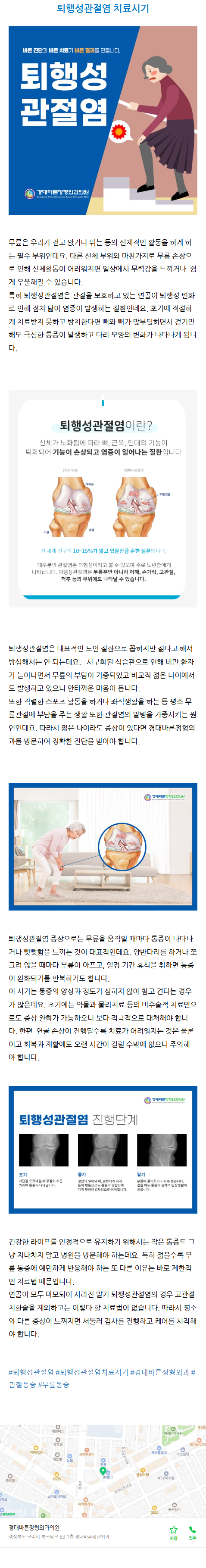 구미문성정형외과 bfxbj