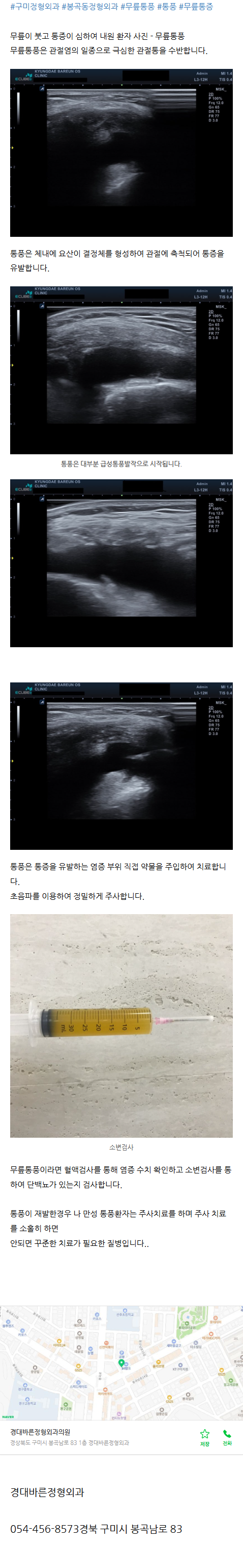 구미봉곡동정형외과 svpcc
