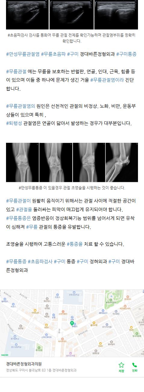 구미도수치료 vvmsa