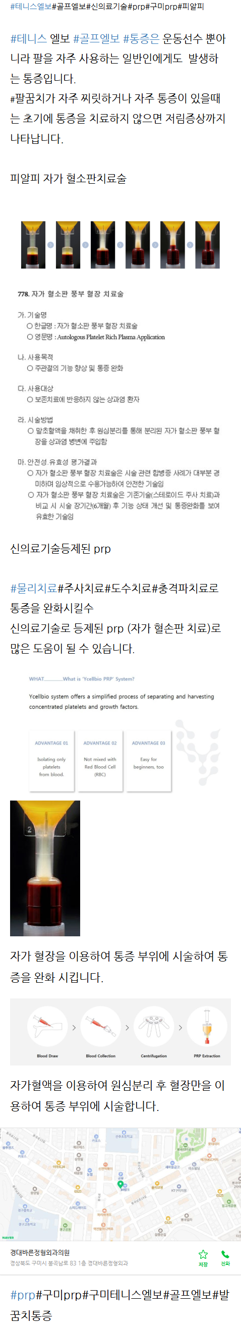 봉곡동정형외과 vfsuo