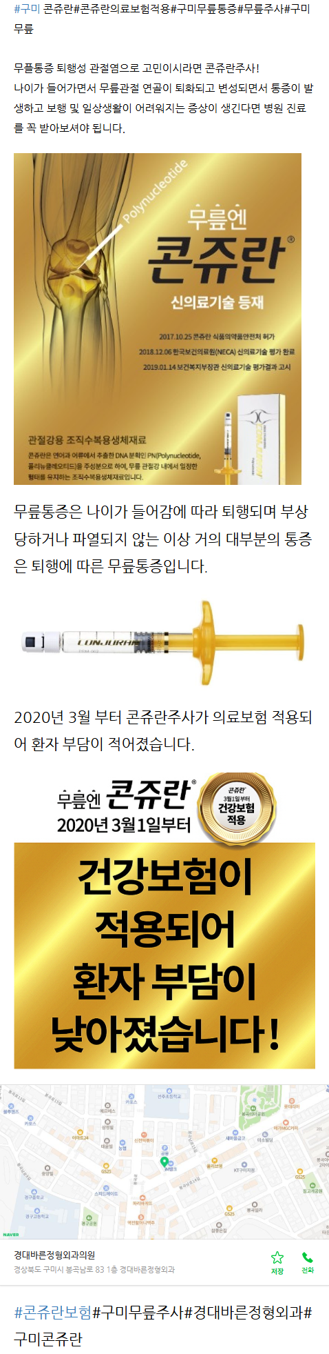 봉곡동정형외과 aiklv